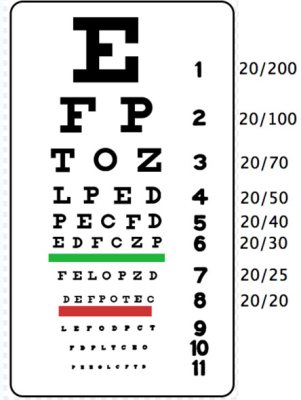 Snellen Chart